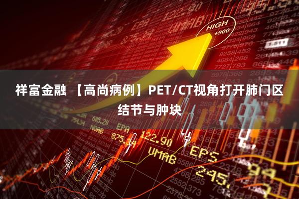 祥富金融 【高尚病例】PET/CT视角打开肺门区结节与肿块